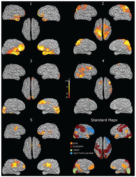 Figure 3 From The Brains Resting State Activity Is Shaped By