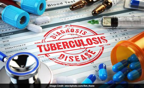 Drug Resistant TB - What Should You Know