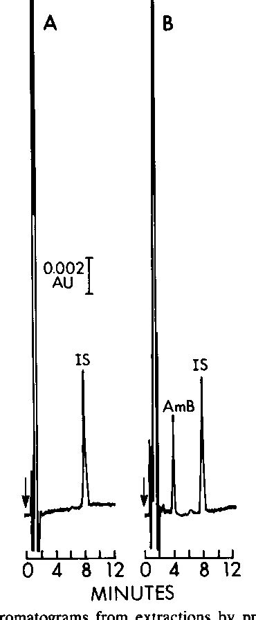 Figure 1 From Sensitive High Pressure Liquid Chromatographic Assay For