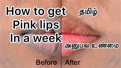 Dark Lips To Pink Lips Naturally Home Remedy