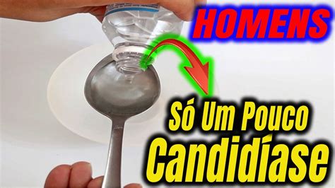 Candidíase MASCULINA RECEITA Rápida para Tratamento EFICAZ YouTube