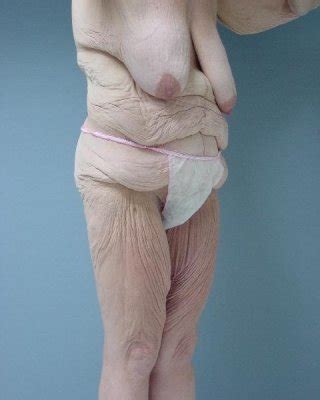 Reifen Oma FKK Porno Bilder Sex Fotos XXX Bilder 1178484 PICTOA