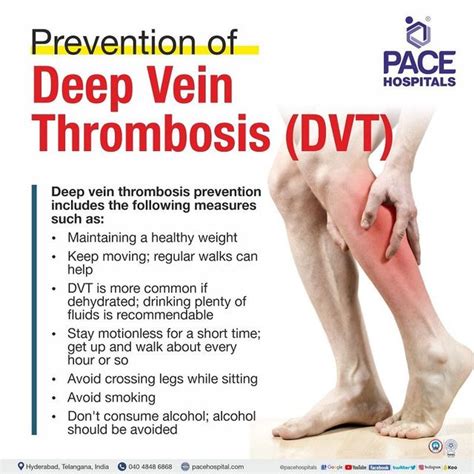 Deep Vein Thrombosis Dvt Causes Symptoms And How To Prevent Deep Vein