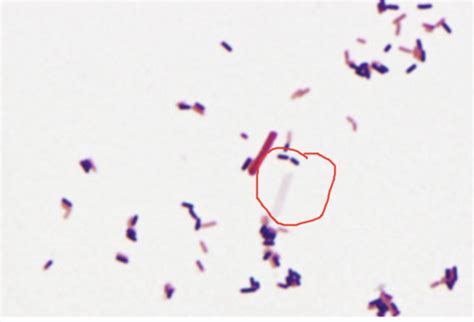 Listeria And Related Gram Positive Bacteria Lecture 6 Flashcards