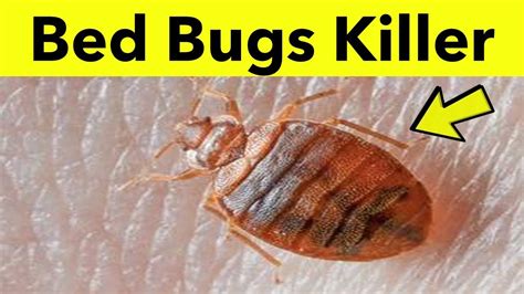 How To Get Rid Of Bed Bugs Fast And Easily At Home 3 Best Home Remedies Youtube