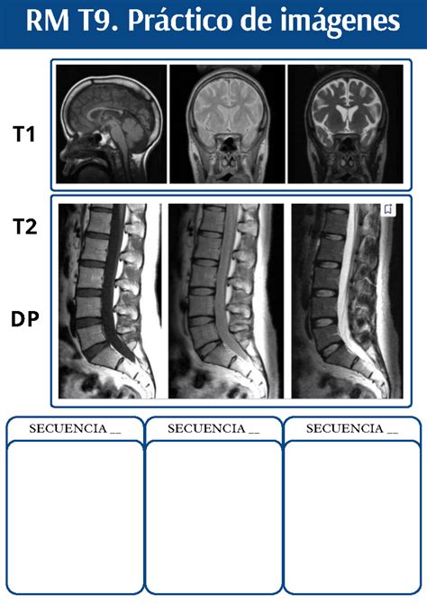 Resonancia Magn Tica Secuencia De Im Genes Resonancia Magn Tica Rm