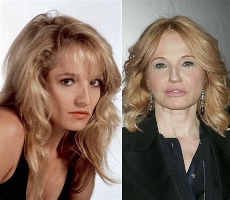 Ellen Barkin Celebrity Plastic Surgery Bad Plastic Surgeries