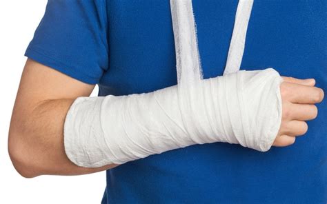 Arm, Elbow & Hand Fracture Compensation Claims | McCarthy + Co