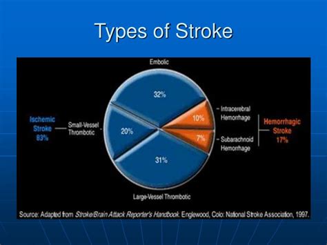 Ppt Cvd Stroke Septemius A Pansacola Rnmd Powerpoint Presentation