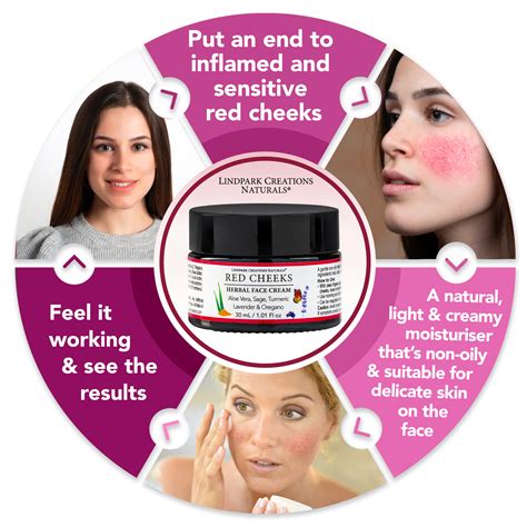 Red Cheeks Herbal Face Cream for Rosacea - LindPark Creations