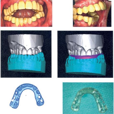 Top Row Preoperative Clinical Situation In Patient 2 A Young Male Download Scientific Diagram