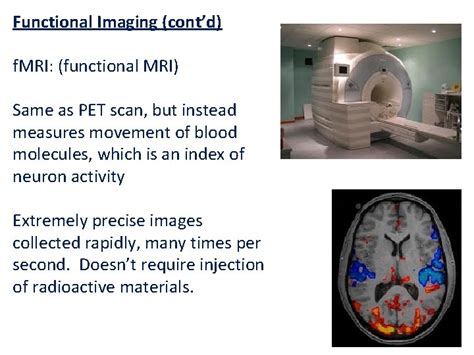 Types Of Brain Imaging Techniques Microelectrode Examines