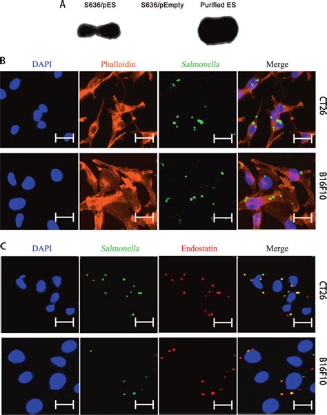 Endostatin Expression And Invasion Of S Pes In Cancer Cells A The