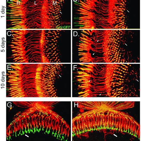 Wnd Expression In R1 6 Photoreceptors Causes Rhabdomere Collapse And Download Scientific