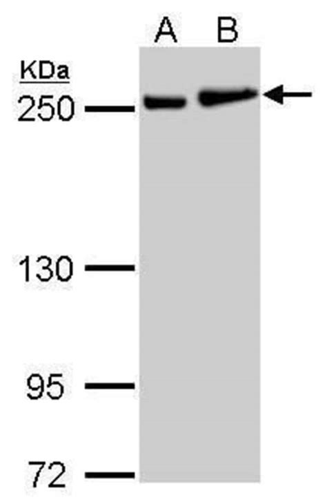 Myh Rabbit Anti Human Polyclonal Invitrogen L Unconjugated