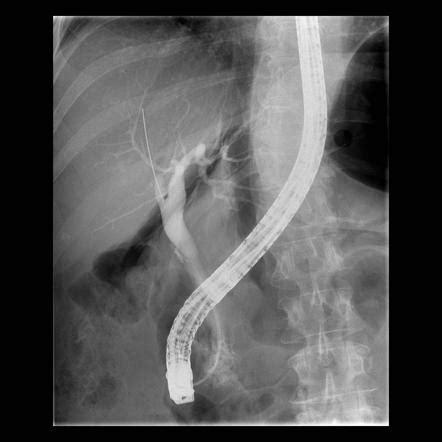 Ercp Anatomy