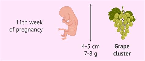 Measurements of an 11-week fetus