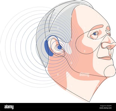 Senior Man Wearing Hearing Aid And Hears Hell Otolaryngology Treatment