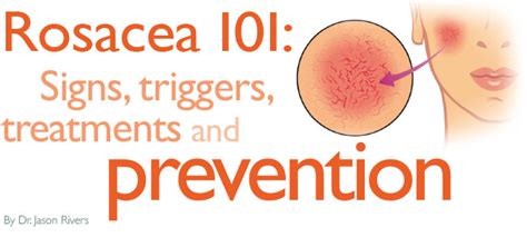 Rosacea 101 Signs Triggers Treatments And Prevention By Dr Jason