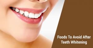 Foods To Avoid After Teeth Whitening Dr David M Silberman General