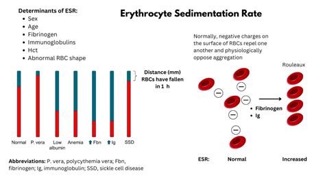 Erythrocyte Sedimentation Rate The Blood Project