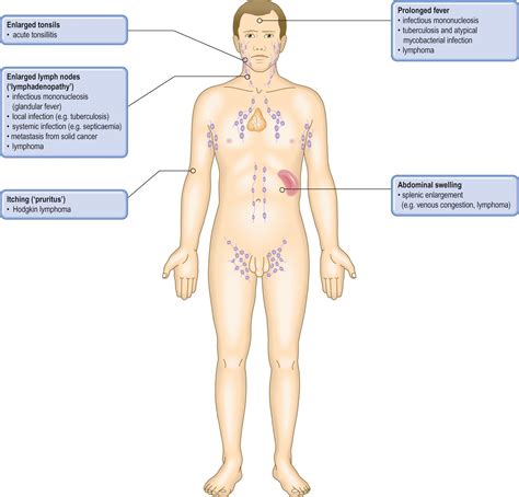 Lymph Nodes And Extranodal Lymphoid Tissue Spleen And Thymus