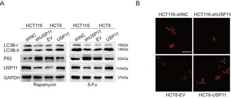 Usp11 Induce Resistance To 5 Fluorouracil In Colorectal Cancer Through