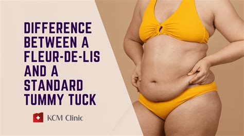 Whats The Difference Between A Fleur De Lis And A Standard Tummy Tuck