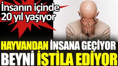 Hayvandan insana geçiyor beyni tamamen istila ediyor İnsanın içinde 20