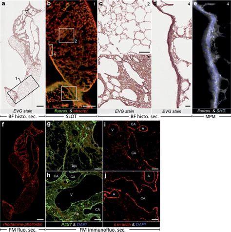 Histological And Fluorescent Sections Of The CRISTAL Sample In