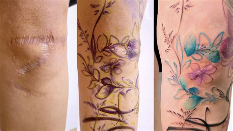 Details More Than 67 Surgery Scar Tattoo Latest In Coedo Vn