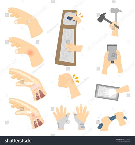 116 Tendinitis Splints Images, Stock Photos & Vectors | Shutterstock