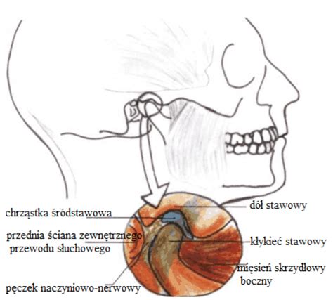 Borelioza Barbara Plucinska choroba z LYME zespól stawu skroniowo