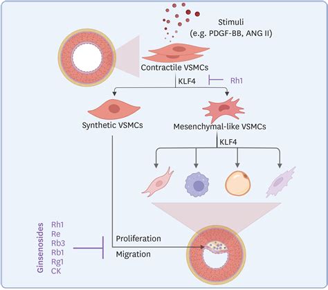 Cmsj Cardiometabolic Syndrome Journal