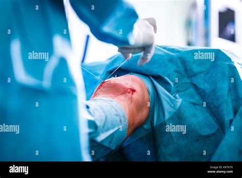 Orthopaedics Hi Res Stock Photography And Images Alamy