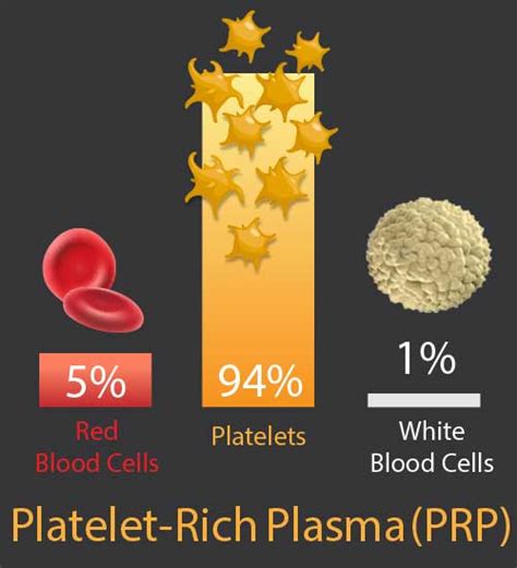 Prolotherapy Formulas Platelet Rich Plasma Prp