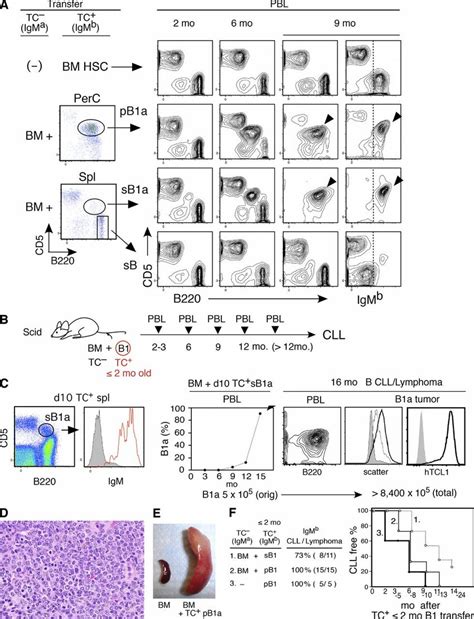 CLL development from early generated B-1–derived B cells. (A ...