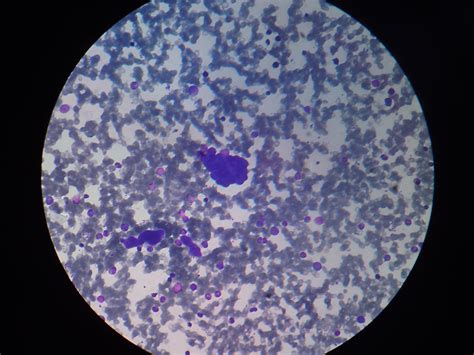 Plasmodium Under Microscope 400x