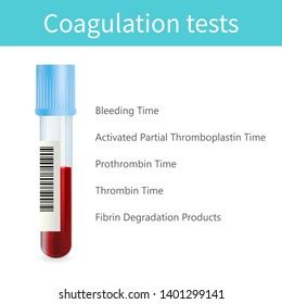 Coagulation Tests Blood Tube Medical Illustration Stock Illustration ...