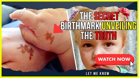 Mom Adopts Girl With Same Birthmark She Screams When She Sees Dna