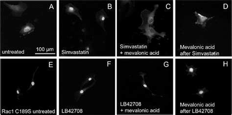 Effects of simvastatin and prenylation on Rac1 localization. This ...