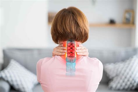 Espondilose Cervical O Que O Que Causa Como Tratar Itc Vertebral