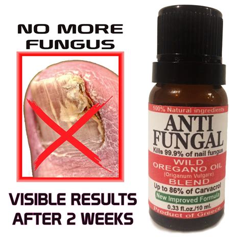 Anti Fungal Wild Oregano Oil Toenail Fungus Athlete S Foot Nail Treatment Fungi Ebay