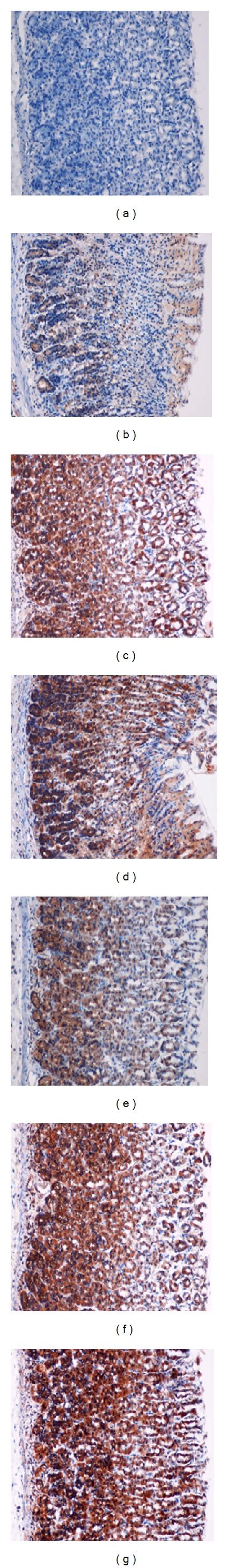 Immunohistochemical Evaluation Of Expression Of Hsp Protein