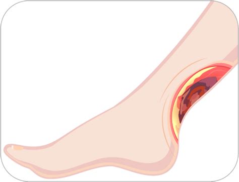 Wound Care Dressing - Maxiocel – Axio Biosolutions