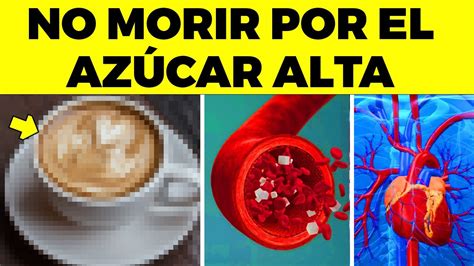 10 Alimentos Comunes Que No Creeras Te Suben Mucho La Glucosa Youtube