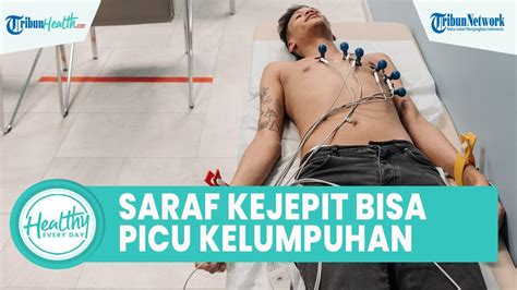 Waspadai Saraf Kejepit Bisa Memicu Kelumpuhan Begini Penjelasan Dr