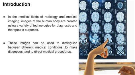 Ppt An Introduction To Radiology And Medical Imaging Powerpoint