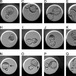 Hatching Of Mouse Embryos In Which One Quarter A Or Half Of The Zona