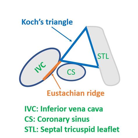 Triangle Of Koch All About Cardiovascular System And Disorders